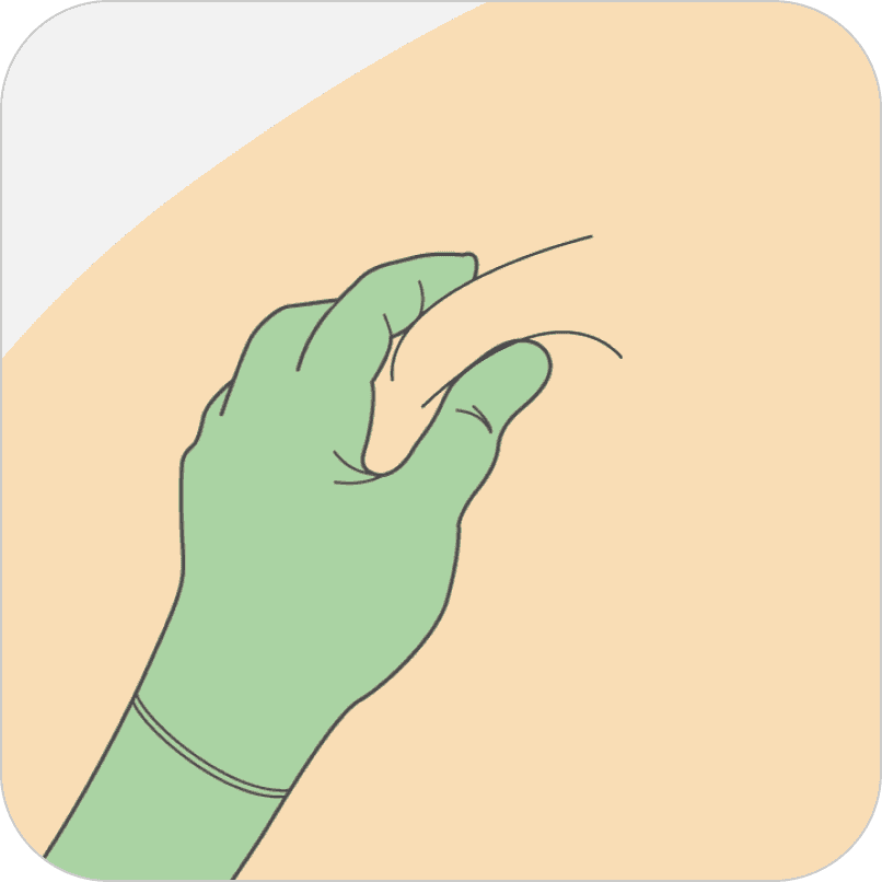 Image showing a gloved hand pinching an injection site.