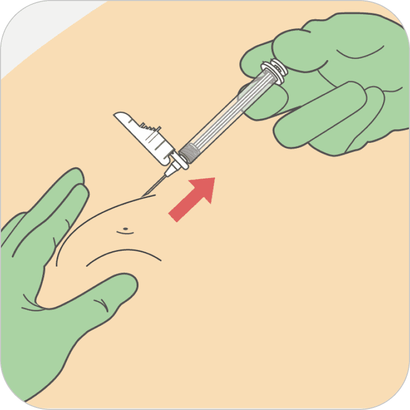 Image showing a gloved hand withdrawing a needle from an injection site.