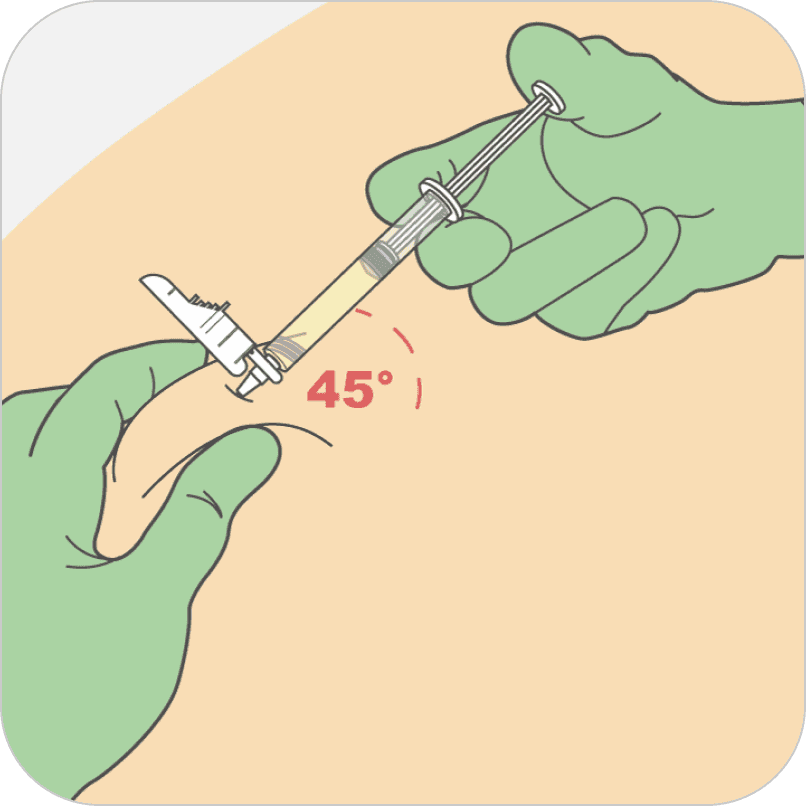Image showing a gloved hand injecting a needle at 45 degrees for an injection.
